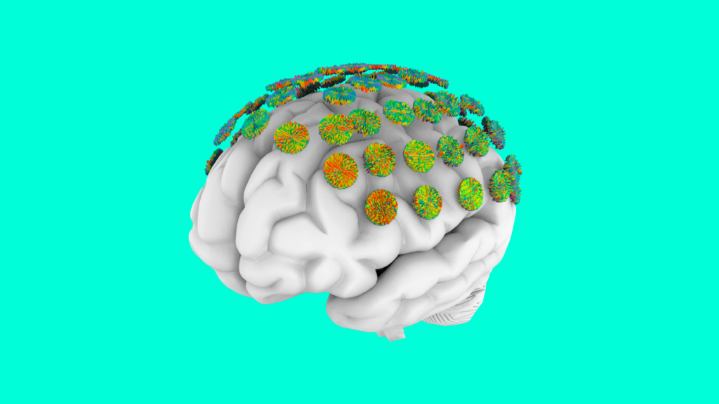 Brain-Entropy-EEG_3D-rev., Marius Jurca